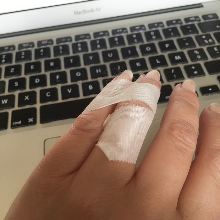 Programmer's RSI fingers - buddy taping fingers